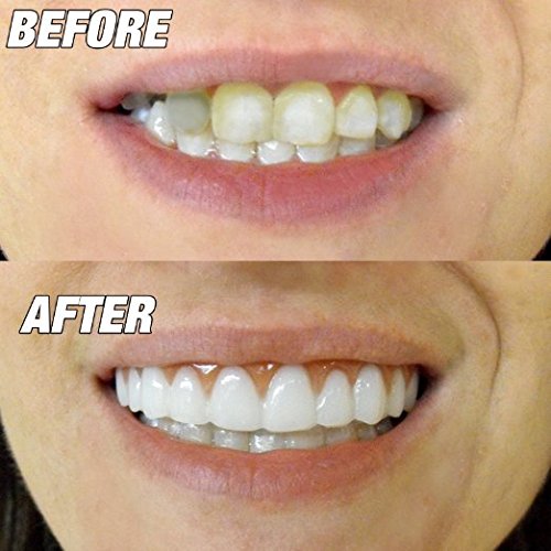 Instant Smile Comfort Fit Flex-Slightly Imperfect Available in Natural White One Size Fits Most People