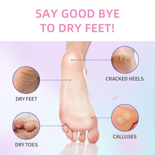 DIANA'S DREAM Foot Cream Moisturizer, Dry|Cracked Foot Repair Ultra-Hydrating Foot Cream Moisturizer, Foot Repair Skin Healing Ointment for Cracked Heels and Dry Feet, 3 oz (1)