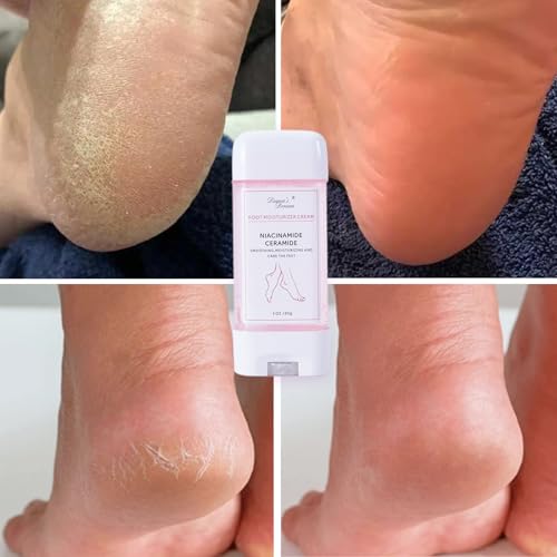 DIANA'S DREAM Foot Cream Moisturizer, Dry|Cracked Foot Repair Ultra-Hydrating Foot Cream Moisturizer, Foot Repair Skin Healing Ointment for Cracked Heels and Dry Feet, 3 oz (1)
