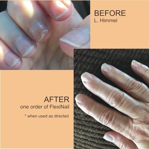 Penetrating Fingernail Conditioner and Strengthener to repair and then maintain weak and peeling or brittle and splitting nails - Single Bottle