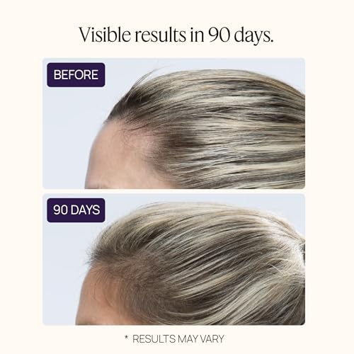 Women's Hair Growth Peptides Capsules, Doctor Recommended, Patented Follicle Fortifying Biotechnology, Clinically Shown to Reduce Hair Loss, 1-Month Supply