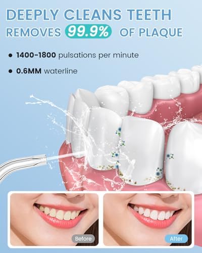 Water Flosser Teeth Pick: 9 Jet Tips Cordless Oral Irrigator with 300ML, 5 Modes Portable Power Dental Flossers, IPX7 Waterproof Rechargeable Electric Waterflosser Machine for Home Travel
