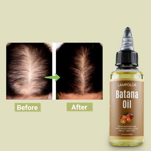 RAW Batana Oil for Hair Growth, Dr Sebi Organic Unrefined Batana Oil from Honduran, 100% Pure & Natural Hair Growth Oil for Thicker & Stronger Hair - 4 FL OZ