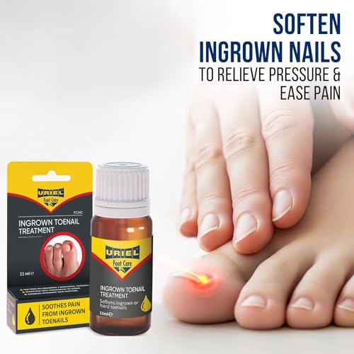 URIEL UPGRADED Ingrown Toenail Treatment, Ingrown Toenail Removal Kit, Ingrown Toenail Corrector, Ingrown Nail Kit Ingrown Toenail Tool 11 ml