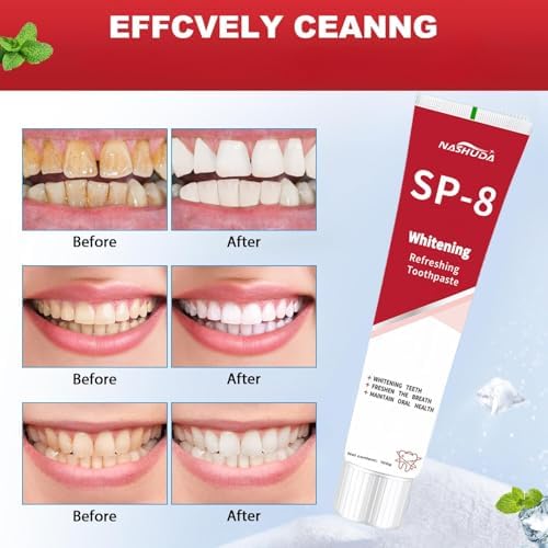SP-8 Probiotic Toothpaste, SP8 Toothpaste Fresh Breath, Deep Cleaning Care (02)