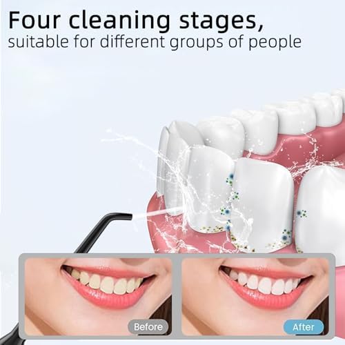 Water Dental Flosser Teeth Pick: Portable Cordless Oral Irrigator 320ML Rechargeable Travel Irrigation Cleaner with 5 Flossing Tips, IPX7 Waterproof Electric Flossing Machine for Teeth Cleaning