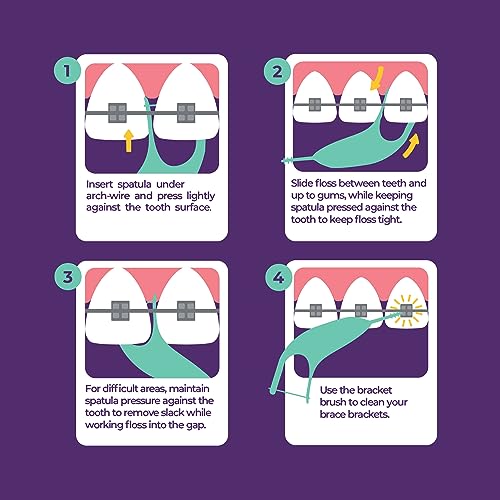 Platypus Orthodontic Flossers for Braces, 30 Count (Pack of 2), Ortho Picks for Adults & Kids, Fits Under Arch Wire, Non-Damaging, Encourage Flossing Habits