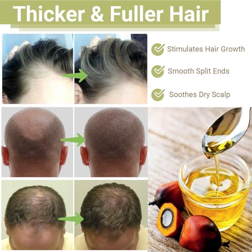RAW Batana Oil for Hair Growth, Dr Sebi Organic Unrefined Batana Oil from Honduran, 100% Pure & Natural Hair Growth Oil for Thicker & Stronger Hair - 4 FL OZ