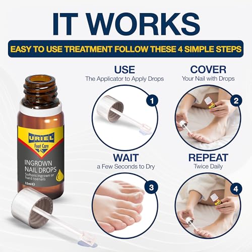 URIEL UPGRADED Ingrown Toenail Treatment, Ingrown Toenail Removal Kit, Ingrown Toenail Corrector, Ingrown Nail Kit Ingrown Toenail Tool 11 ml