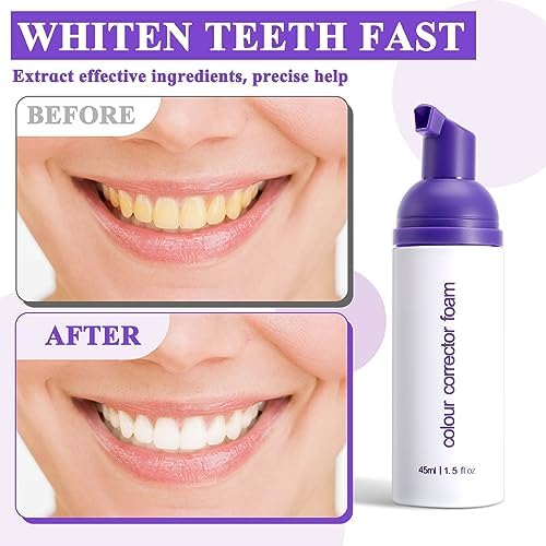 Purple Toothpaste for Teeth Whitening,Purple Teeth Whitening Kit,Tooth Stain Removal Colour Corrector,2PC