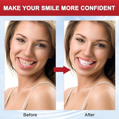 SP-8 Probiotic Toothpaste, SP8 Toothpaste Fresh Breath, Deep Cleaning Care (02)