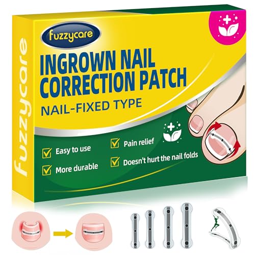 Titanium Alloy Ingrown Toenail Treatment & Removal Kit for Quick Relief, Ingrown Toenail Removal Kit， Professional Ingrown Toenail Corrector, Ingrown Toenail Tools for Quick Relief, 10 Pcs