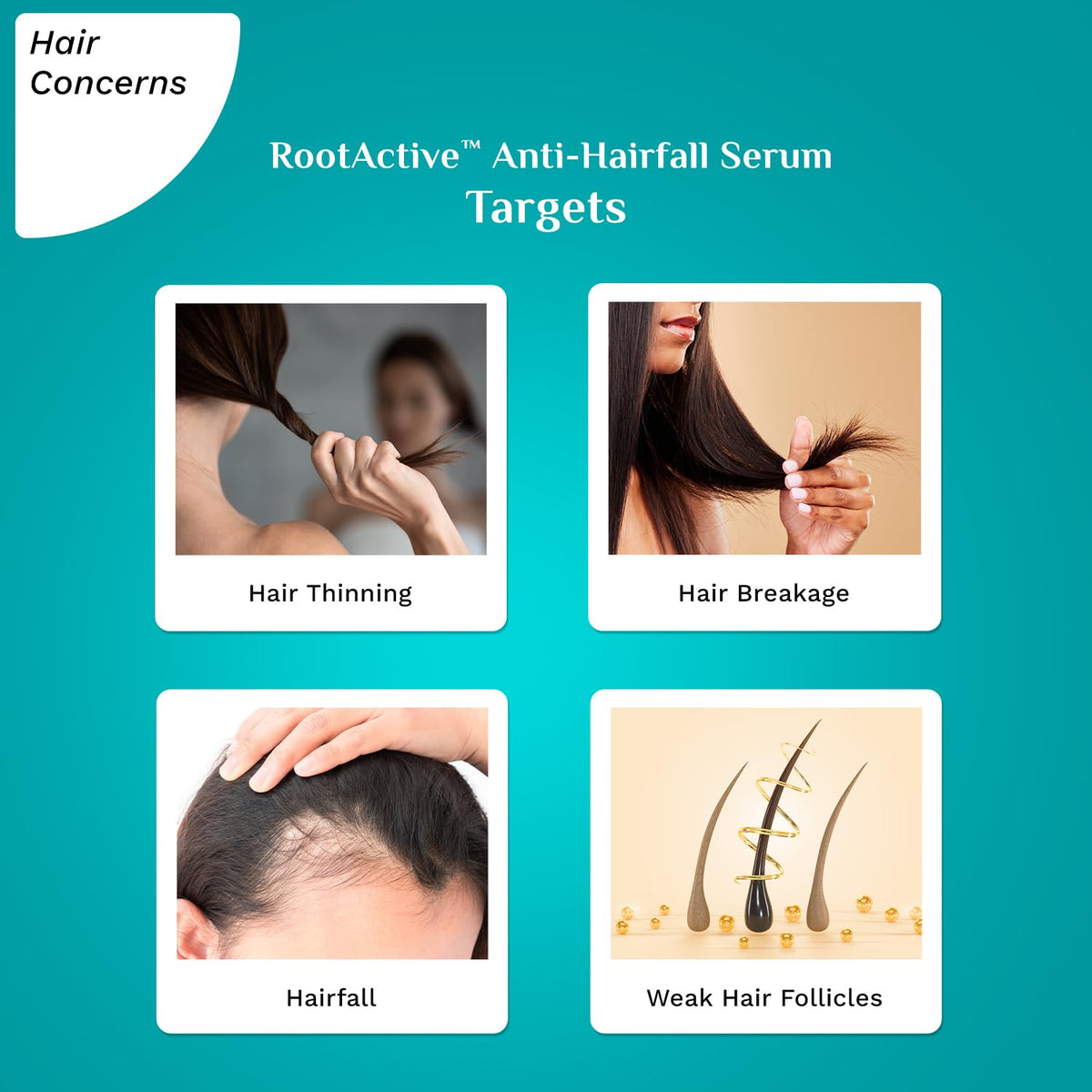 Rosemary Hair Serum for Hair Fall – Pilgrim RootActive Anti-Hairfall Serum with Caffeine, Biotin, Capilia Longa & Saw Palmetto | Reduces Hair Loss | For Men & Women | 1.01 Fl Oz (30ml)