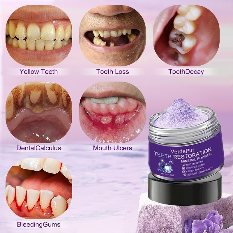 Purple Teeth Whitening Powder Simply Purple Gentle Tooth Whitener for Daily Use Enamel Friendly Brightening That Removes Stains Dentist Approved Alternative to Whitening Toothpaste
