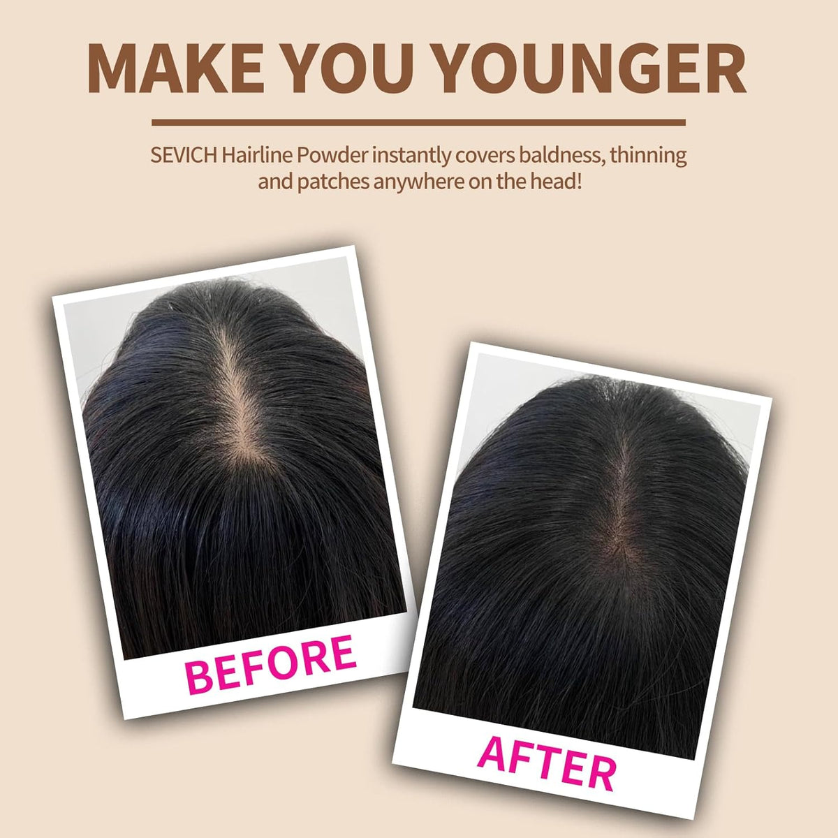 SEVICH Hairline Powder - Instantly Cover Grey Hair and Thinning Hairline, Eyebrows & Beard Line Touch Up, Windproof & Sweatproof, Auburn